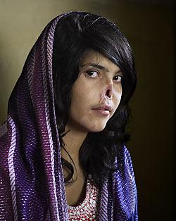 World Press Photo winner 2010 bibi aisha disfigured taleban