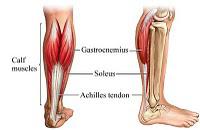 Delayed Onset Muscle Soreness - DOMS - My poor Calves!