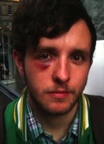 Punchlines: comics getting beaten up Gareth Ellis suffers for his art (photo by Lewis Schaffer)