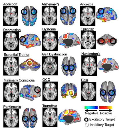 Brain resting state network stimulation for psychiatric and neurological diseases
