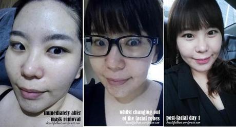 Review / Facial: Hadara Dermagold Power Facial and Lazer Glow Hadara Dermagold Facial (10)