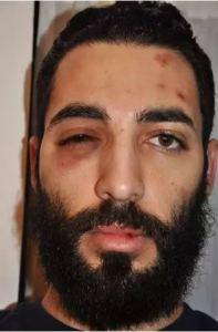 “Coexist” street artist beaten to a pulp by Muslims Combo suffered a dislocated shoulder, bruises and a black eye.