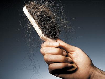Simple Home Remedies to Control Hair Fall Immediately Hair Fall Home Remedies