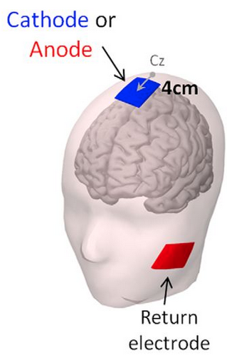 Impulse control with weak currents applied to the head - a new therapy?