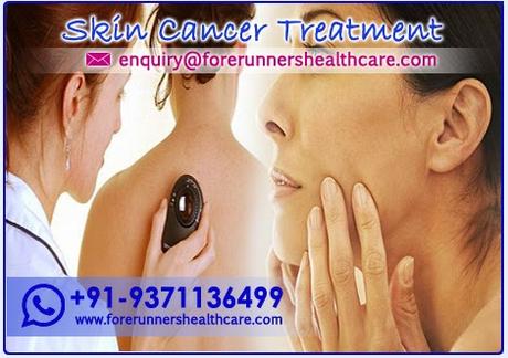 Cheap Cost Skin Cancer Treatment In India by Internationally Trained Surgeons