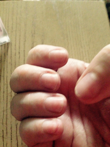 Healing my nails after acrylics.