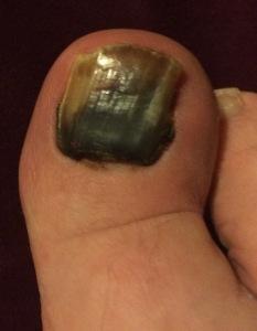 A Rumble, women talking about their sex lives, Fringe awards and my big toe toenail
