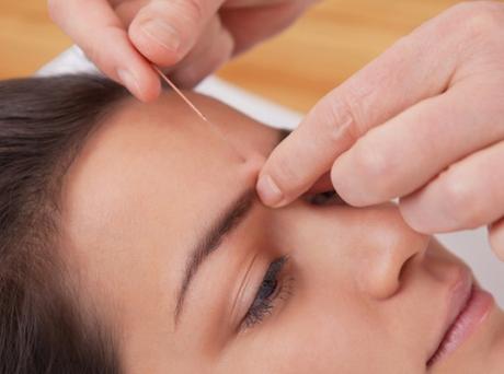 How Effective And Safe Is It To Have Acupuncture During Pregnancy? How Effective And Safe Is It To Have Acupuncture During Pregnancy?