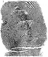 Stupid Criminals: Man Attempts to Gnaw Off His Fingerprints