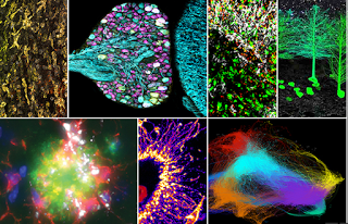 A picture show; and, Alzheimer's and the innate immune system A picture show; and, Alzheimer's and the innate immune system