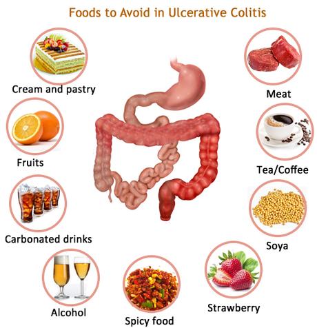 Diet and herbal remedies for ulcerative colitis
