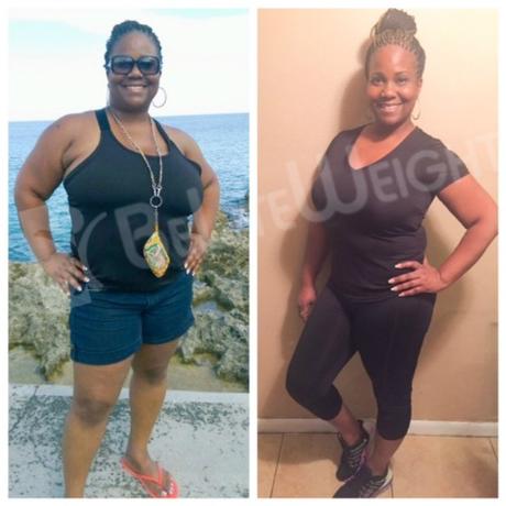 Medication Free in 6 Months: Torre’s Benefits After Bariatric Surgery