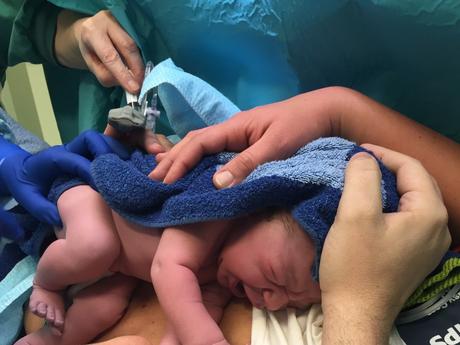 When can I start exercise after c-section? When can I start exercise after c-section?