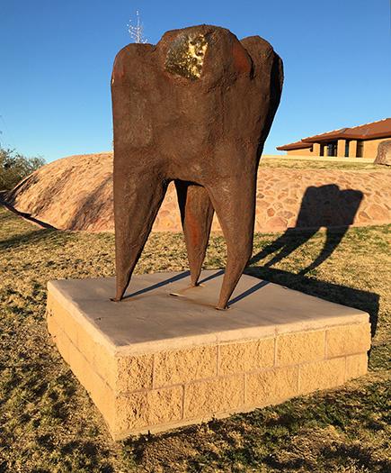 Tooth sculpture in Oracle