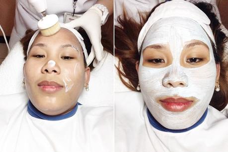 My Dermclinic Intense Diamond Peel Experience My Dermclinic Intense Diamond Peel Experience