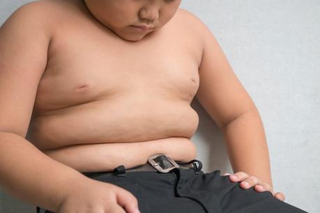 Shocking Childhood Obesity Trends – and Still Going Up!