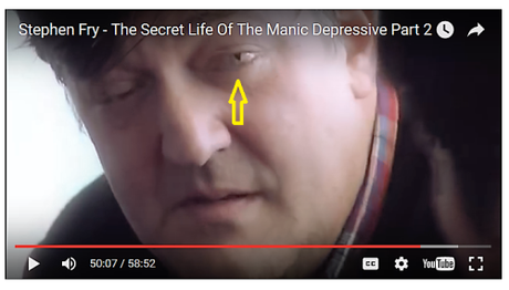 Is this the infamous reptilian eye? Stephen Fry's reptilian left eye