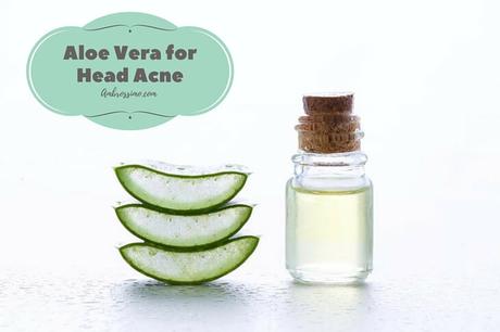 Aloe Vera for scalp Acne Treatment - home remedies for slin care