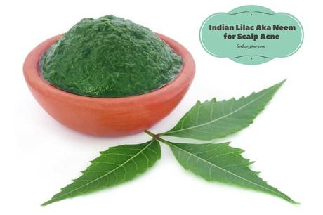 Home Remedy for Skalp Acne - Neem aka Indian Lilac