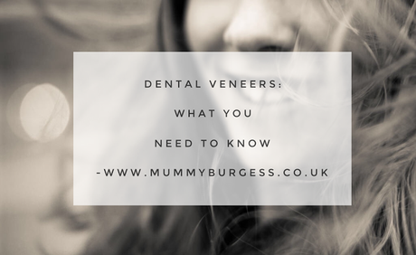 Dental Veneers: What you need to know