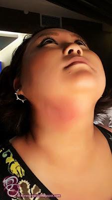 ClearSK Launches New Treatments & Privileges With Its Newest Centre At Kallang ClearSK Launches New Treatments & Privileges With Its Newest Centre At Kallang