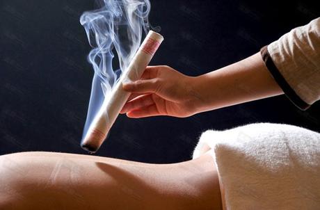 Traditional Chinese Medicine: That Time I Tried Acupuncture in China….Alone! moxa- acupuncture