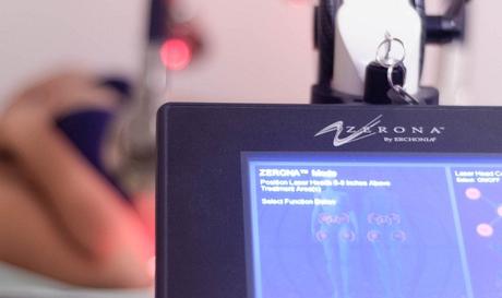 Contours LaserFit: Non-invasive fat-busting solution LaserFit