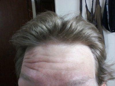 The Day I…Got Loads of Spots on My Head in Senegal The Day I...Got Loads of Spots on My Head in Senegal