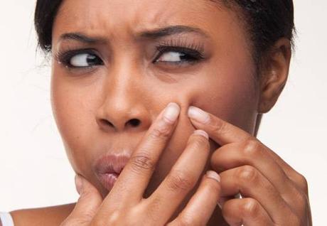 7 Mistakes we make when we have zits 7 Mistakes we make when we have zits
