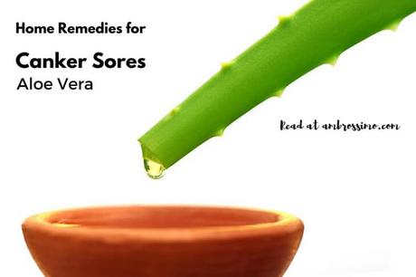 Aloe Vera - Home Remedies for Canker Sores