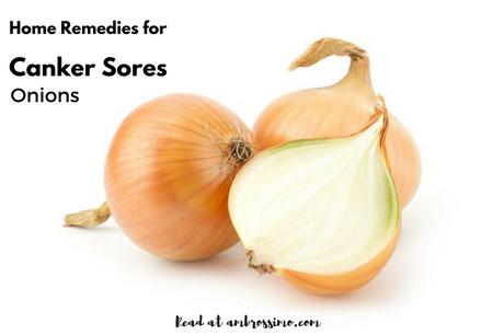 Onions for Canker Sores