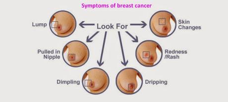 Understanding Breast Cancer : Prognosis and Life Expectancy