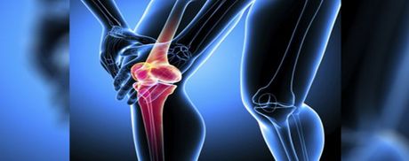 Manipal Hospital Bangalore India offers Low Cost Knee Replacements Surgery to fight from Osteoarthritis Manipal Hospital Bangalore India offers Low Cost Knee Replacements Surgery to fight from Osteoarthritis