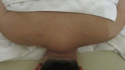 Rejuvenating the Body at Polarity Prehabilitation Rejuvenating the Body at Polarity Prehabilitation