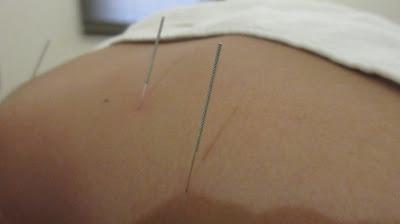 Rejuvenating the Body at Polarity Prehabilitation Rejuvenating the Body at Polarity Prehabilitation