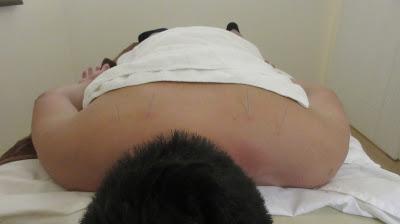 Rejuvenating the Body at Polarity Prehabilitation Rejuvenating the Body at Polarity Prehabilitation