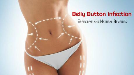 Belly Button Infection Treatment