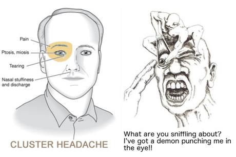What is a headache?, The four most common types of headache, and can you hurt your brain by thinking too much?