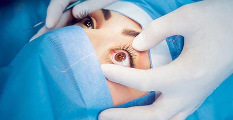 Eye Surgery Cost in India