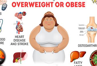 Obesity Overweight Risk Factors And Causes -weight Loss Herbal 