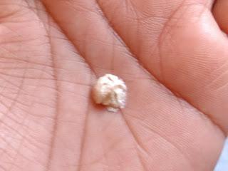 Is Himalaya Herbals Acne n Pimple Cream the right thing to tame Acne? Is Himalaya Herbals Acne n Pimple Cream the right thing to tame Acne?
