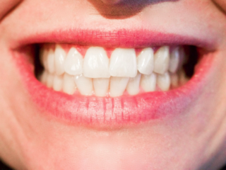 Let’s Make Sure Your Kid’s Teeth Shine teeth5