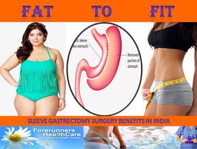 Get Best Price Laparoscopic Sleeve Gastrectomy Surgery in India : Contact Forerunners Healthcare Get Best Price Laparoscopic Sleeve Gastrectomy Surgery in India : Contact Forerunners Healthcare