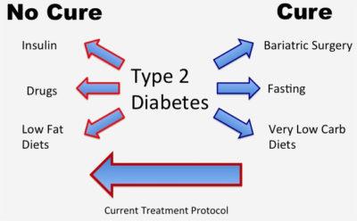 Towards a Cure for Type 2 Diabetes