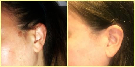 NeoStrata Bionic Face Serum Works! NeoStrata Bionic Face Serum Works!