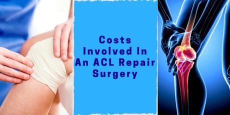 Costs Involved In An ACL Repair Surgery