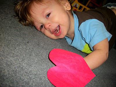 Williams Syndrome Awareness Day 3: Complexity Williams Syndrome Awareness Day 3: Complexity