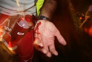 TNF 100 – 2011 Race Review and Lessons Learnt TNF 100 – 2011 Race Review and Lessons Learnt