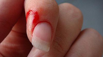 Why Do Paper Cuts Hurt So Much?