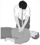 Are You Sure You Know How to Administer CPR?